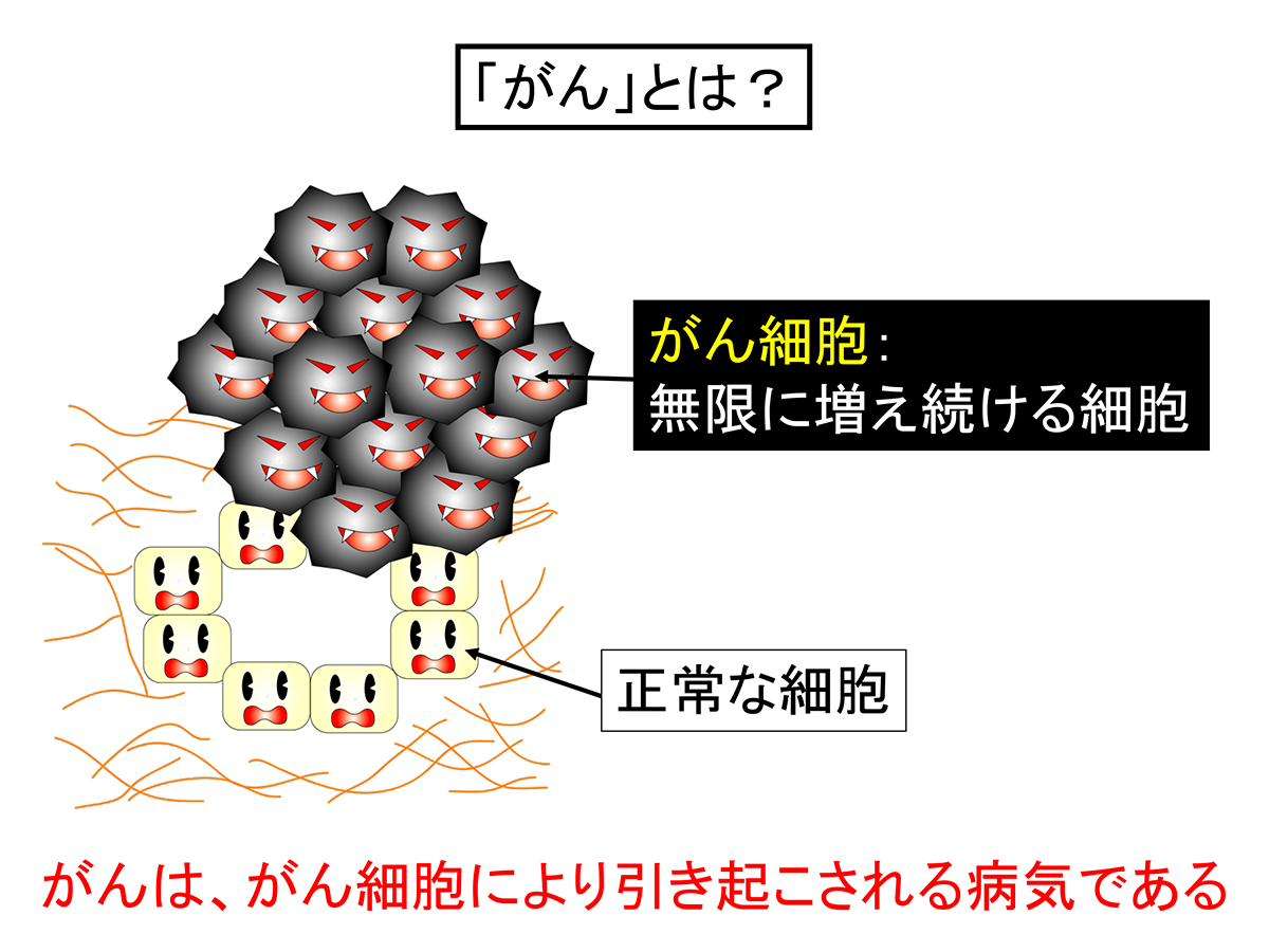 “がん” とは? – 北海道大学 大学院先端生命科学研究院 先端融合科学研究部門 細胞ダイナミクス科学研究室 石原誠一郎ウェブサイト